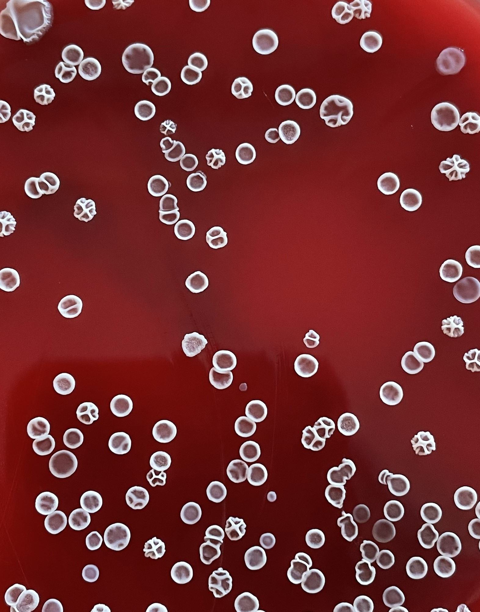 Colonie di Bacillus cereus